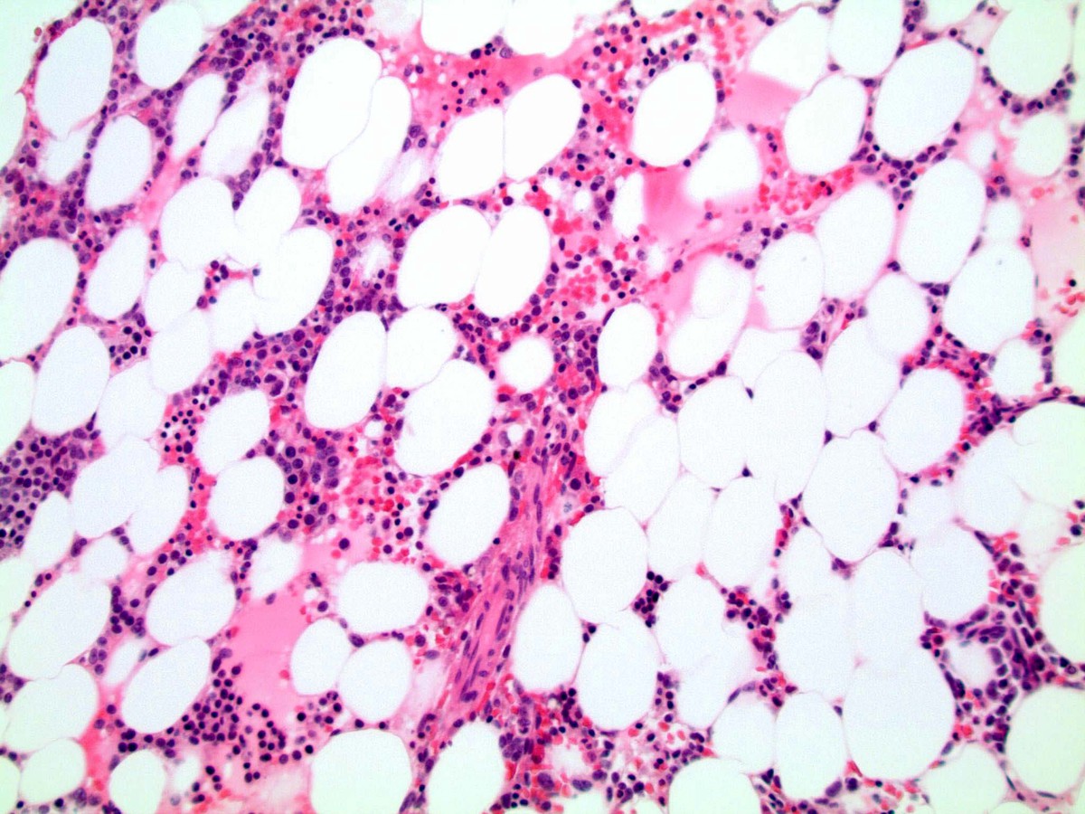 Biopsy core 200x